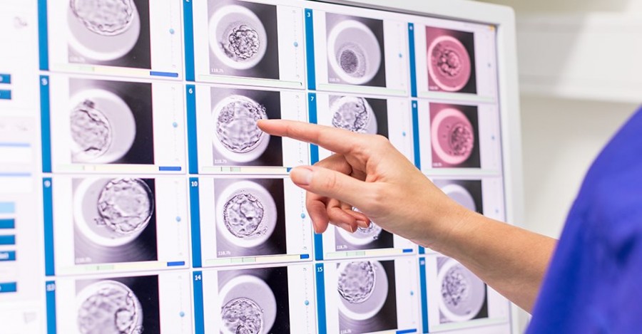 Igin s’équipe d’embryoscope + et d’intelligence artificielle pour une meilleure sélection embryonnaire